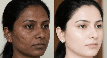 Nissa Beauty Cream – Zafrani Beauty Cream | Moisturizes Skin & Gives a Healthy Glow